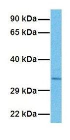 Anti-GLS2 antibody, Internal used in Western blot. GTX46870