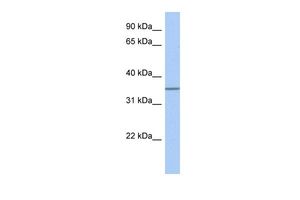 Anti-GLT6D1 antibody, Internal used in Western blot. GTX46116
