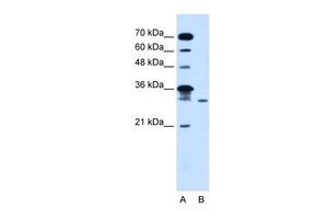 Anti-GLTPD2 antibody, Internal used in Western blot. GTX46655