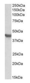 Anti-GLUT4 antibody, C-term used in Western blot. GTX88031