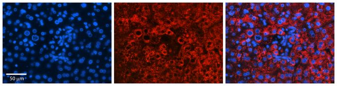 Anti-GLYAT antibody, N-term used in IHC (Formalin-fixed paraffin-embedded sections). GTX46205