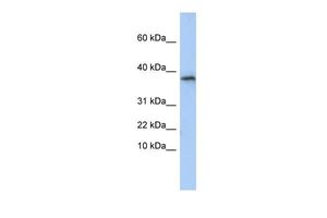 Anti-GLYAT antibody, N-term used in Western blot. GTX46205