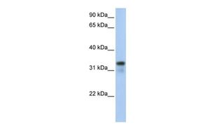 Anti-GLYATL2 antibody, Internal used in Western blot. GTX46143