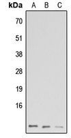 Anti-GNG13 antibody used in Western blot. GTX56099