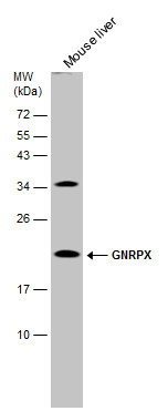 Anti-GNRPX antibody [C1C3] used in Western blot. GTX108055
