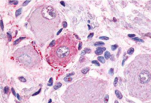 Anti-GPCR MRGE antibody used in IHC (Formalin-fixed paraffin-embedded sections). GTX71501