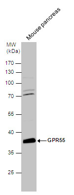 Anti-GPR55 antibody used in Western blot. GTX108243
