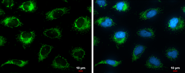 Anti-Grp75 antibody used in Immunocytochemistry/ Immunofluorescence. GTX133283