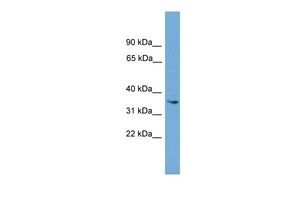 Anti-ASB17 antibody, Internal used in Western blot. GTX45761