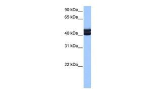 Anti-GSG1 antibody, C-term used in Western blot. GTX45447