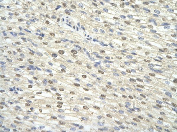 Anti-GTF2H3 antibody, N-term used in IHC (Formalin-fixed paraffin-embedded sections). GTX77809