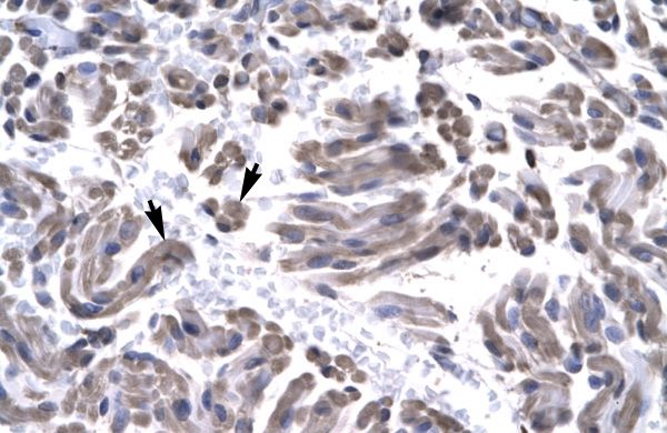Anti-GTF2H3 antibody, N-term used in IHC (Formalin-fixed paraffin-embedded sections). GTX77809