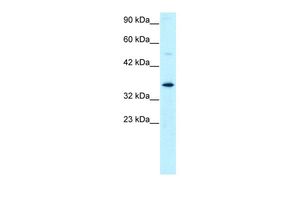Anti-GTF2H3 antibody, N-term used in Western blot. GTX77809