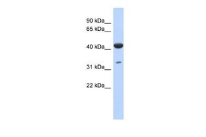 Anti-HCG_1745121 antibody, N-term used in Western blot. GTX44832
