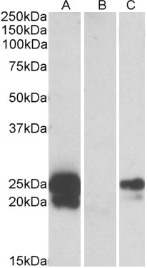 Anti-HE4 antibody, Internal used in Western blot. GTX88122