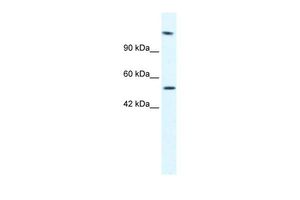 Anti-HELB antibody, N-term used in Western blot. GTX47497