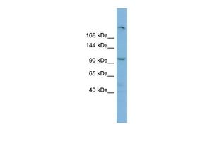 Anti-HERC4 antibody, Internal used in Western blot. GTX46908