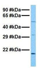 Anti-HERV-FRD antibody, N-term used in Western blot. GTX45132