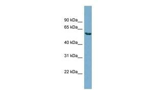Anti-HHAT antibody, N-term used in Western blot. GTX46303