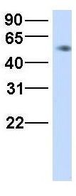 Anti-HHAT antibody, N-term used in Western blot. GTX46303