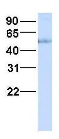 Anti-HHAT antibody, N-term used in Western blot. GTX46303