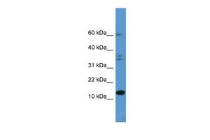 Anti-HINT2 antibody, C-term used in Western blot. GTX49048