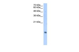 Anti-HIST2H2AA3 antibody, Internal used in Western blot. GTX45851