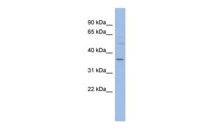 Anti-HMGCLL1 antibody, N-term used in Western blot. GTX45075