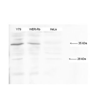 Anti-HMX1 antibody, Internal used in Western blot. GTX48949