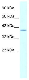 Anti-HMX1 antibody, Internal used in Western blot. GTX48949