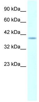 Anti-HMX1 antibody, Internal used in Western blot. GTX48950