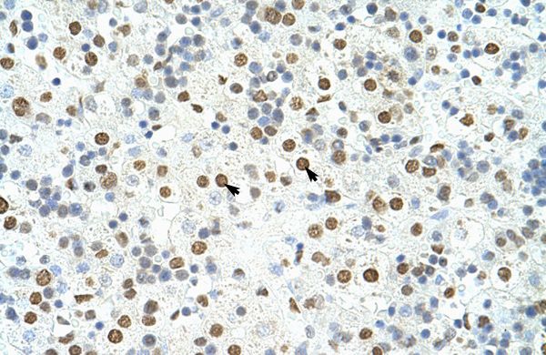 Anti-HNRPA3 antibody, N-term used in IHC (Formalin-fixed paraffin-embedded sections). GTX47186