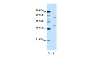 Anti-HNRPA3 antibody, N-term used in Western blot. GTX47186