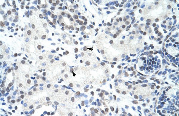 Anti-HNRPH3 antibody, N-term used in IHC (Formalin-fixed paraffin-embedded sections). GTX47329
