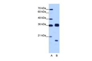 Anti-HNRPH3 antibody, N-term used in Western blot. GTX47329