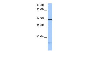 Anti-HS3ST5 antibody, C-term used in Western blot. GTX46133