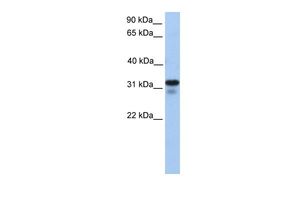 Anti-HS3ST6 antibody, C-term used in Western blot. GTX46226