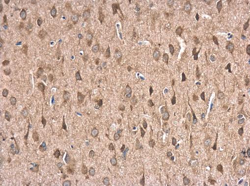 Anti-HSPA1B antibody used in IHC (Formalin-fixed paraffin-embedded sections). GTX106148