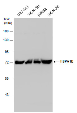 Anti-HSPA1B antibody used in Western blot. GTX112963