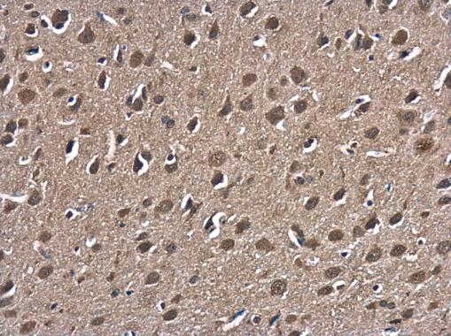 Anti-HSPA1B antibody used in IHC (Formalin-fixed paraffin-embedded sections). GTX112963