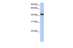 Anti-ICA1L antibody, Internal used in Western blot. GTX45740