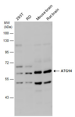 Anti-ATG14 antibody used in Western blot. GTX128166