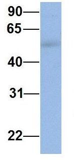 Anti-IFIT5 antibody, Internal used in Western blot. GTX45362