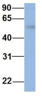 Anti-IFIT5 antibody, Internal used in Western blot. GTX45362