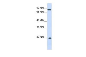 Anti-IFNA7 antibody, N-term used in Western blot. GTX45291
