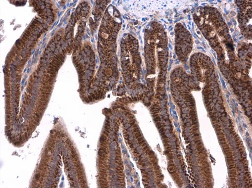 Anti-ATP5J antibody used in IHC (Formalin-fixed paraffin-embedded sections). GTX110996