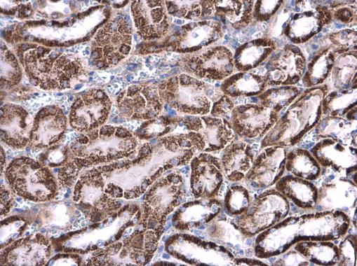 Anti-ATP5J antibody used in IHC (Formalin-fixed paraffin-embedded sections). GTX110996