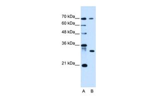 Anti-ATP6AP1L antibody, C-term used in Western blot. GTX46648