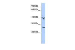 Anti-ATP6V0E2 antibody, Internal used in Western blot. GTX45821
