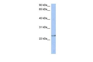 Anti-ATP6V1E2 antibody, Internal used in Western blot. GTX44838